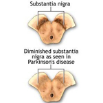 substantia nigra b