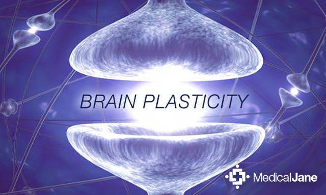 Plasticity 3d