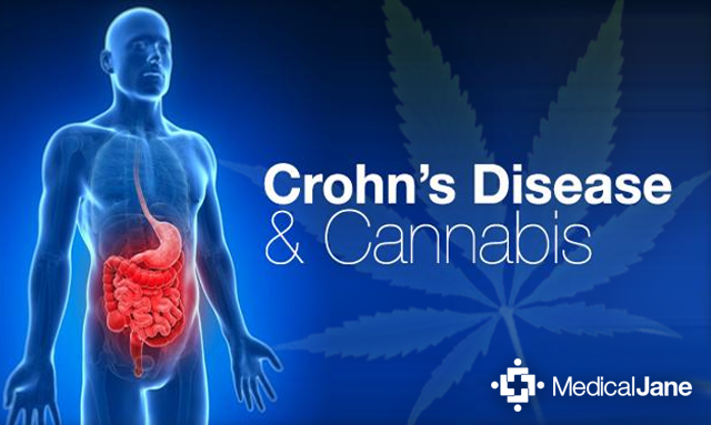 What are symptoms of Crohn's disease?