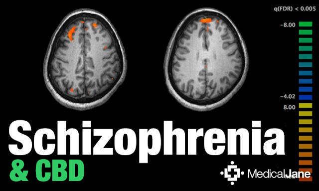 CBD May Improve Sensory Gating With Schizophrenia