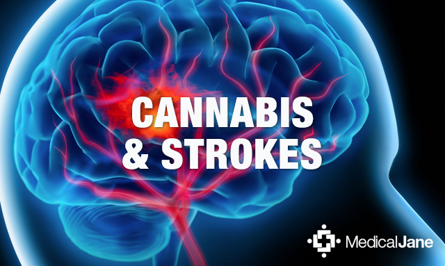 How Can CBD Help In The Treatment Of Stroke