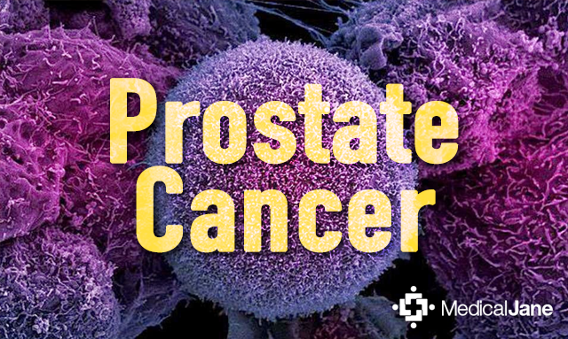 Endocannabinoids in the Treatment of Prostate Cancer